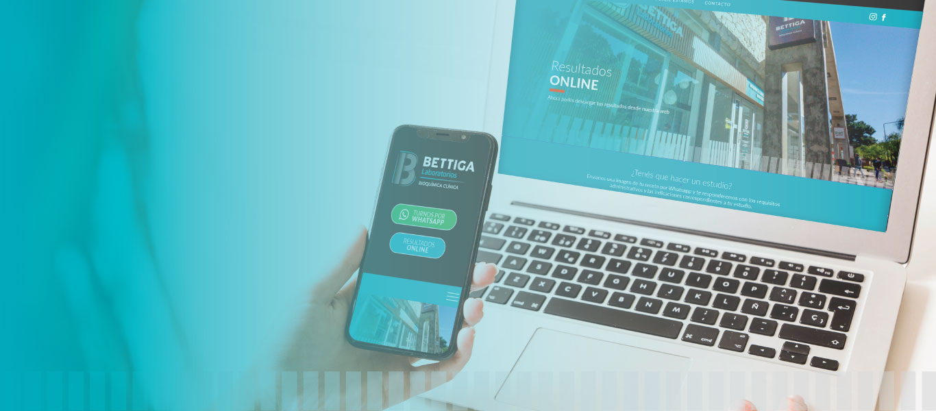 Bettiga